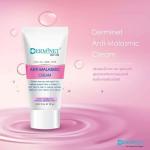 Anti-Malasmic Creamm